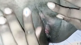 Village Milf Spreading Hairy Pussy Wide Open For Everyone Now